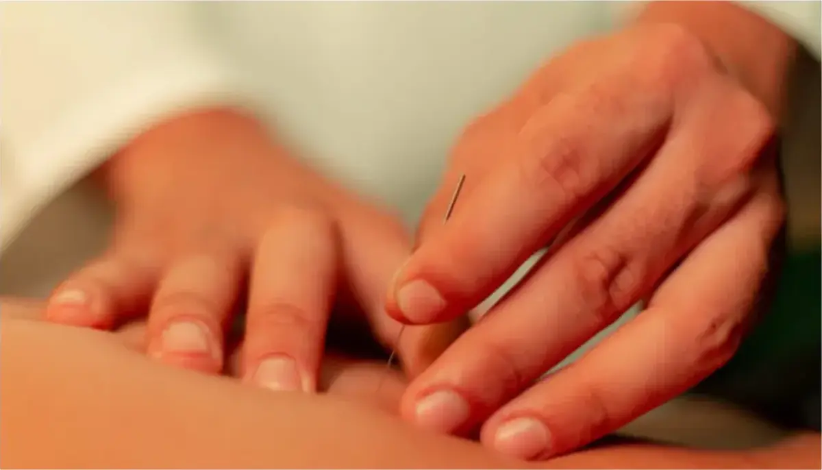Japanese Acupuncture 和鍼